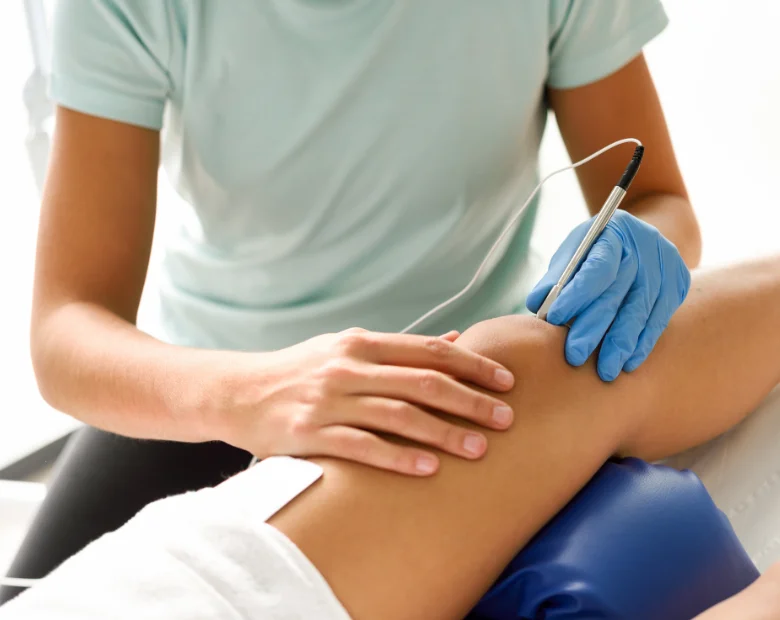 dry needling koekelberge